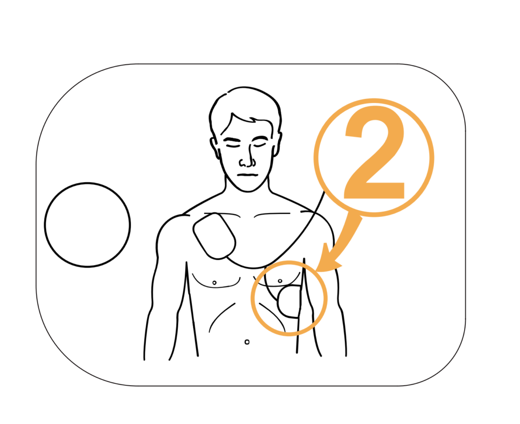 Defibrillator AED iPAD CUSP1 für optimale Rettung