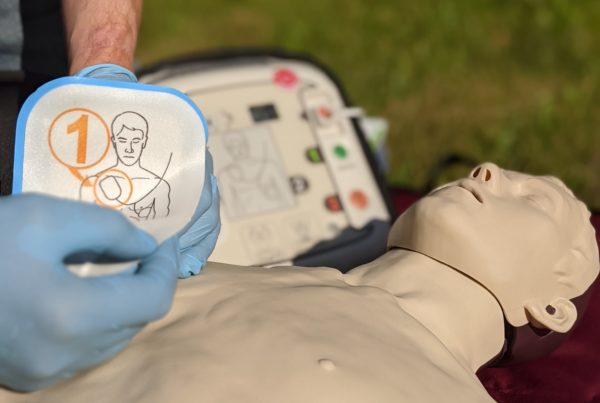 Defibrillationselektroden des iPAD CU-SP1 anbringen