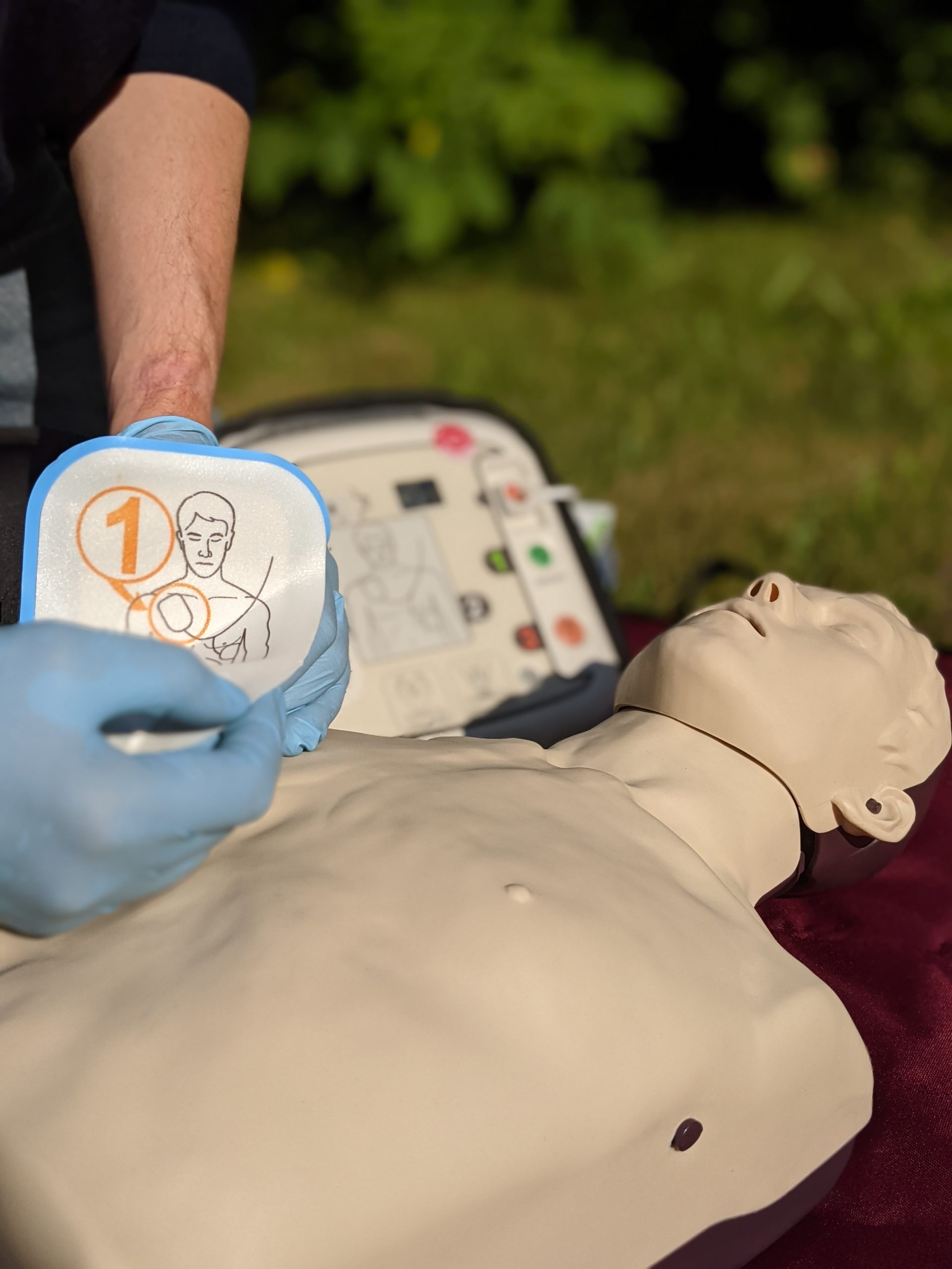 5 Gründe, warum die Herz-Lungen-Wiederbelebung mit einem Defibrillator wichtig ist