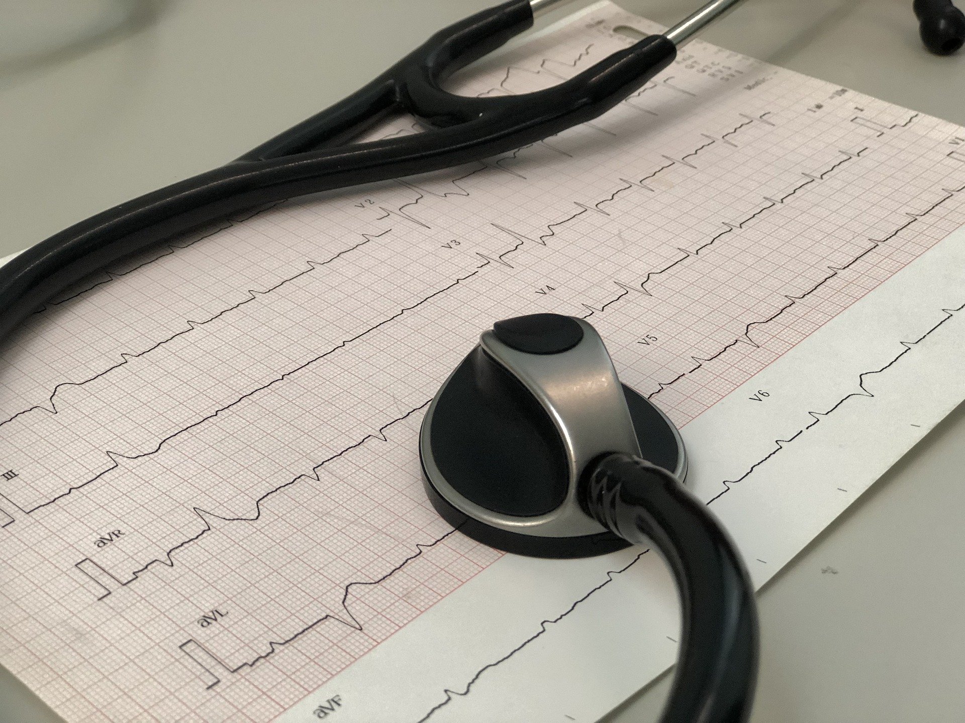 EKG Herzinfarkt Vorsorge